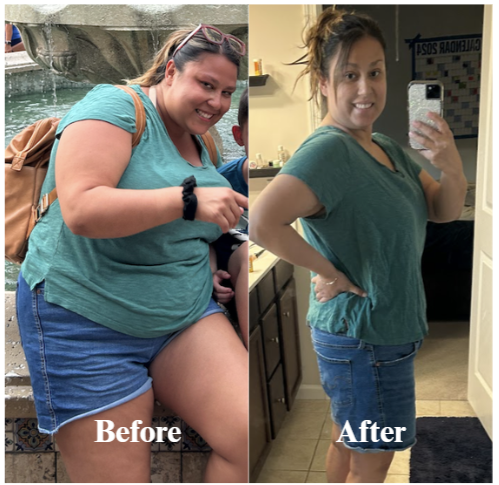 BMI MD GLP-1 Microdosing Benefts